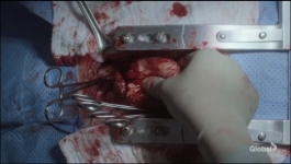 New Amsterdam - Season 03 Episode 06